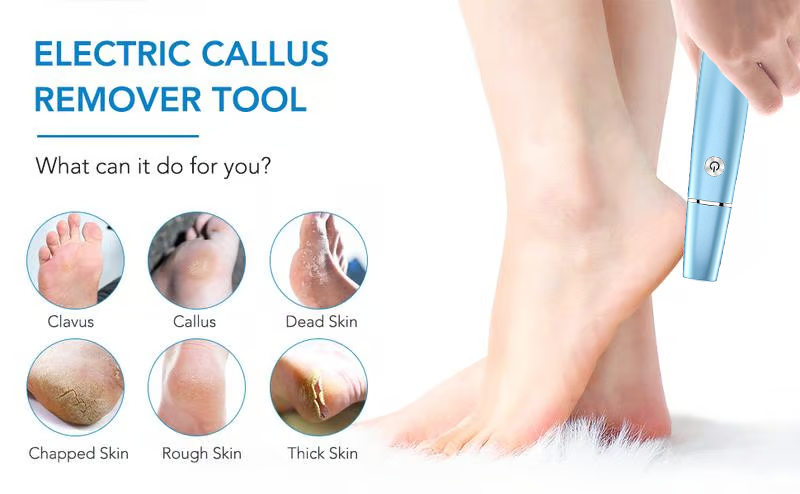 🔥Flash Sale - 50% OFF🔥Electric Foot Callus Remover⚡