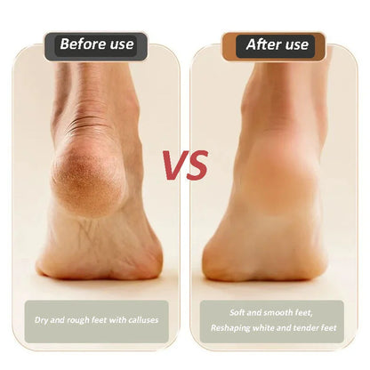 🔥2024 New Arrival💝New Digital Electric Foot Polisher