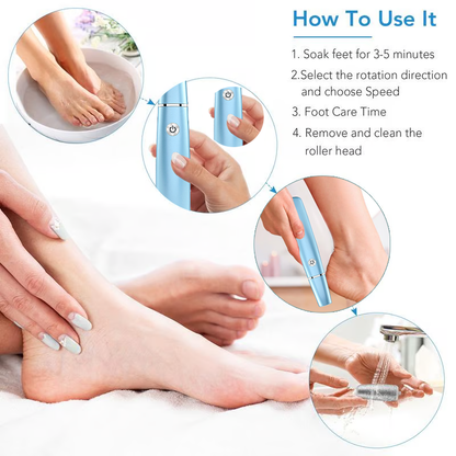 🔥Flash Sale - 50% OFF🔥Electric Foot Callus Remover⚡